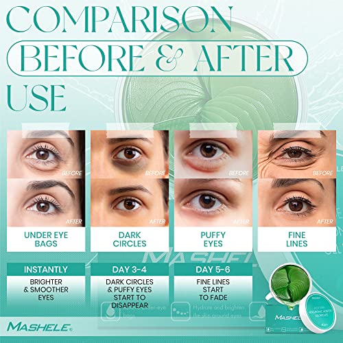 MASHELE Aloe Vera Jel Göz Maskesi Cilt Bakımı - 60 Adet - Hyaluronik Asit Kollajen Koyu Halkalar ve Şişlik için göz