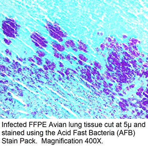 Asit Hızlı Bakteri (AFB) Leke Paketi, 500ml